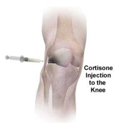 Gavrilyuk Oleg, MD - Knee Cortisone Injection