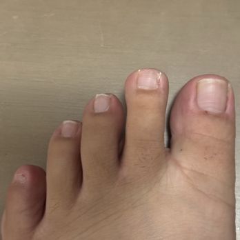 Ilash Nails & Spa - Improper nail salon pedicure - Nail Salons Near Me - Kapolei, Hawaii Ilash Nails & Spa - Improper nail salon pedicure - Nail Salons Near Me - Kapolei, Hawaii