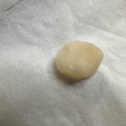 Bridgewater Family Dental - That's picture shows how very bad job in Bridgewater family dental. Lol shame