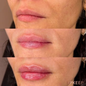 UPKEEP - Medical Spas Near Me - New York, New York UPKEEP - Medical Spas Near Me - New York, New York