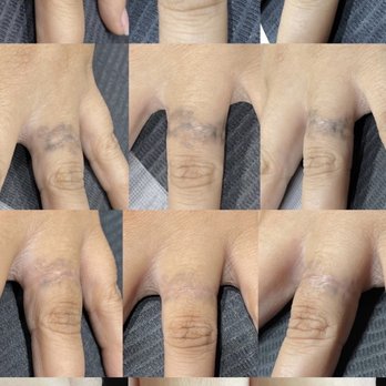 1 Point Tattoo - 3 sessions for amazing results! - Tattoo Near Me - Kailua, Hawaii