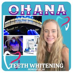 Ohana Teeth Whitening By DaVinci