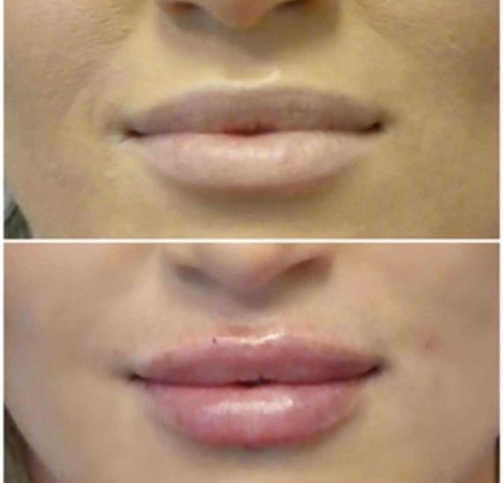 DENVER PLASTIC SURGERY DR. CHRISTINE RODGERS Updated October 2024