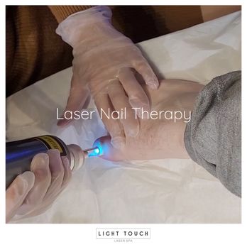 Light Touch Laser Spa - Laser Nail Therapy - Light Touch Laser Spa NYC - Laser Hair Removal Near Me - New York, New York Light Touch Laser Spa - Laser Nail Therapy - Light Touch Laser Spa NYC - Laser Hair Removal Near Me - New York, New York