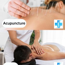 Healing Sense Clinic - Registered Acupuncturists in Burnaby are accepting new patients and Healing Sense Clinic offers direct billings.