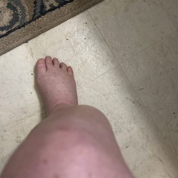 Arrowhead Travel Plaza  - My injury knee front leg feet hands and body - Gas Stations Near Me - Pendleton, Oregon