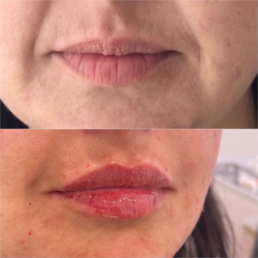 GLAM BAR MEDICAL SPA 30 Photos & 21 Reviews 346 N La Cienega Blvd