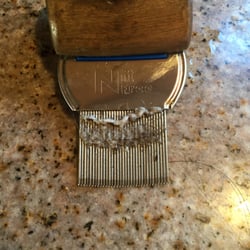 Head Lice Guru - This is a major infestation of head lice.