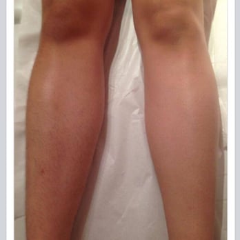 The Wax Studio - Before and after pic of half leg wax. $25. - Waxing Near Me - San Diego, California The Wax Studio - Before and after pic of half leg wax. $25. - Waxing Near Me - San Diego, California