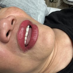 Cosmetica Anti-Aging, Aesthetic Lasers, Slimming & Medspa  - Vibrant lip blush
