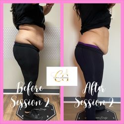 Body sculpting helps reduce stubborn fat with an addition to your already established healthy diet and exercise