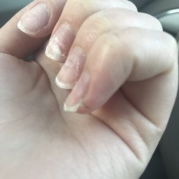 Nails destroyed. Slice on pinky finger from drill. Nails destroyed. Slice on pinky finger from drill.