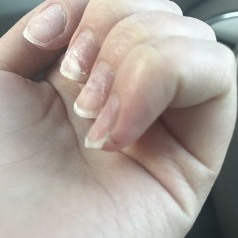 Paris Nails Spa - Nails destroyed. Slice on pinky finger from drill. - Skin Care Near Me - Clarksville, Tennessee Paris Nails Spa - Nails destroyed. Slice on pinky finger from drill. - Skin Care Near Me - Clarksville, Tennessee