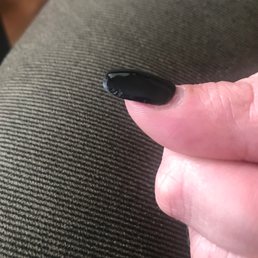 Chip on my right thumb