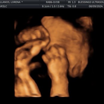 Blessings 3D 4D Ultrasound - Diagnostic Imaging Near Me - Palmdale, California Blessings 3D 4D Ultrasound - Diagnostic Imaging Near Me - Palmdale, California
