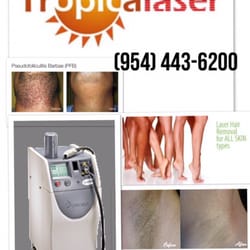 Tropicalaser Beauty Spa - Tropicalaser of Pines - Call us: (954)443-6200 Free consultation, Cavi-Lipo, microdermabrasion, chemical peel, facials