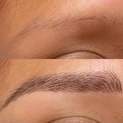 Skin and Scar Rejuvenation