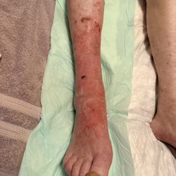 Coast Wound Care