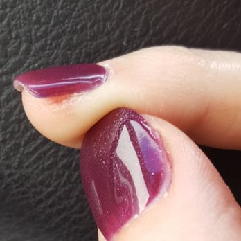 Gem Nail Bar - Cut pinky from excessive filing. And good view of spots on thumb. - Nail Salons Near Me - Long Beach, California