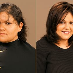 Thursday's Hair Solutions - Hair Replacement for Women, Non-Surgical, Safe Before & After
