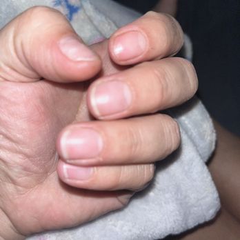 Angela Nail Spa - 8 days later no more nails - Nail Salons Near Me - Santa Ana, California