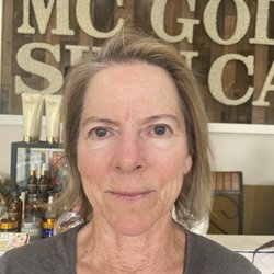 MCGoldSkinCare - After the facial