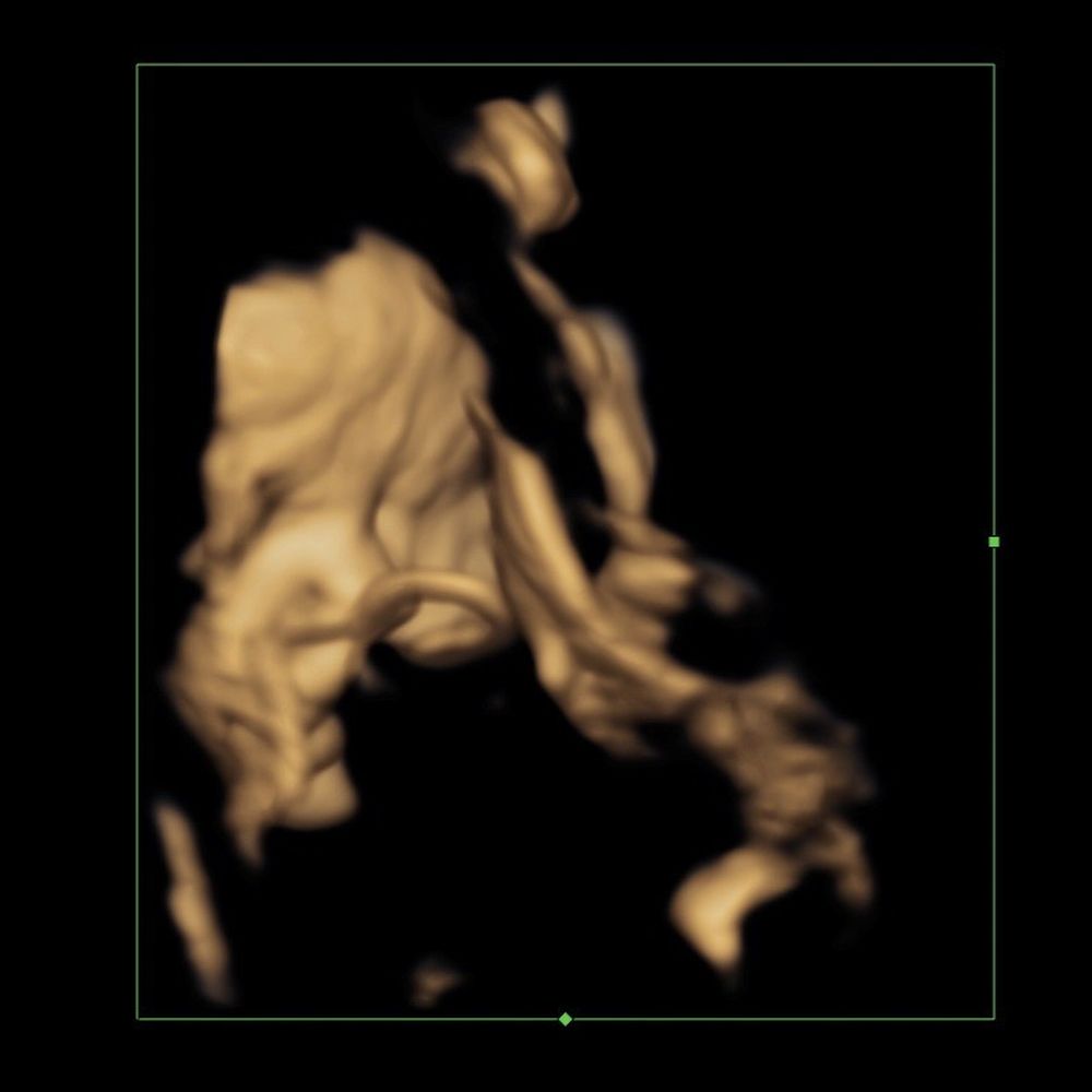 Womb in Bloom - 4D that I got - Diagnostic Imaging Near Me - Redding, California Womb in Bloom - 4D that I got - Diagnostic Imaging Near Me - Redding, California