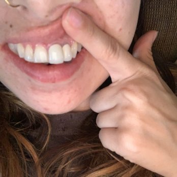 Paul Taylor, DMD - Advanced Dentistry - General Dentistry Near Me - San Diego, California Paul Taylor, DMD - Advanced Dentistry - General Dentistry Near Me - San Diego, California