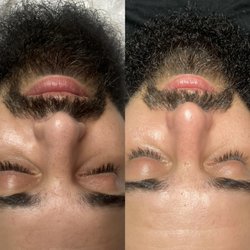 Before x after. Facial and Beard treatment