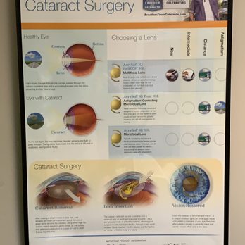 Willy Ky, MD - Cataract Info - Ophthalmologists Near Me - Flushing, New York