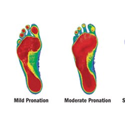Main Street Chiropractic - Be supported the right way. Individually designed orthotics based on digital images or impressions of your feet.