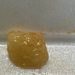 I found hair in Carapulcra I found hair in Carapulcra