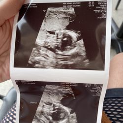 Peek A Baby Boutique
