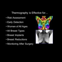 New Dimensions Integrative Therapies - Breast Thermography