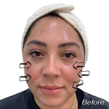 JT Aesthetic - Tattoo Removal Near Me - Eastvale, California JT Aesthetic - Tattoo Removal Near Me - Eastvale, California