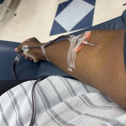 CSL Plasma - Me following instructions and keeping my arm straight. There is no bruising. I was awakened every time I fell asleep.