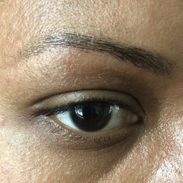 Right eye Right eye