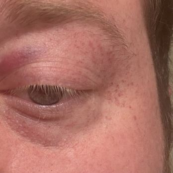 Kurogi - Food poisoning - Ramen Near Me - Northlake, Texas Kurogi - Food poisoning - Ramen Near Me - Northlake, Texas
