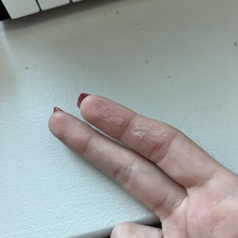 Venezia Nail Spa - somehow my skin deteriorating - Nail Salons Near Me - Prosper, Texas Venezia Nail Spa - somehow my skin deteriorating - Nail Salons Near Me - Prosper, Texas