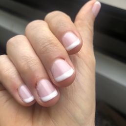 Nails two days about appointment. Still red and puffy Nails two days about appointment. Still red and puffy