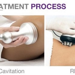 Fetch Figures - Cavitation and RF