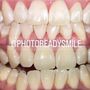 Photo of Photoreadysmile
