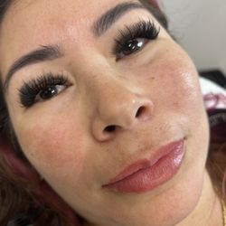 Glowing Grace Aesthetics - Lip Filler