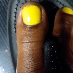 Chipped nail