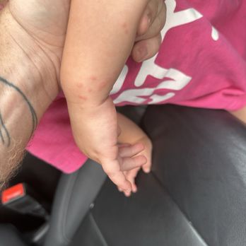 Boston / Cape Cod KOA - Bed bug bites on my 2 year old - Campgrounds Near Me - Middleboro, Massachusetts