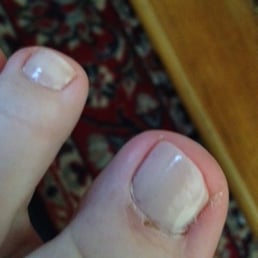 Trimmed too much off the sides of my nails, was rough and made my cuticle bleed, still a week later it is finally starting to heal.