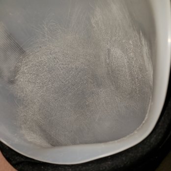 Barnhart Prosthetic & Orthotic Services - Here  you can see I reamed out the base where the Tibula was rocking after hydrolics... - Prosthetics Near Me - Springfield, Oregon