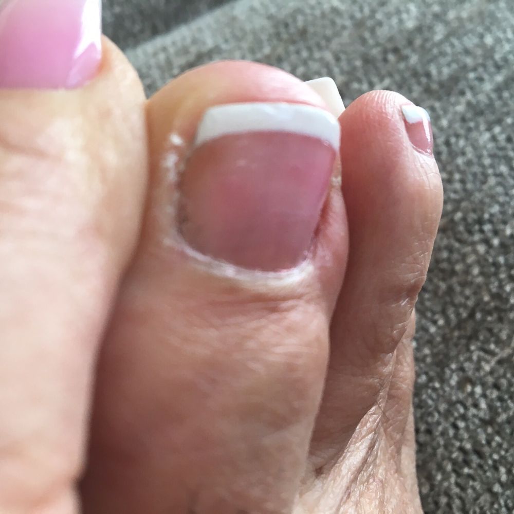 Roseville Nails Spa - 1st. Day of pedicure! My cuticles we're not trimmed nor wear my heels buffed out - Nail Salons Near Me - Roseville, California Roseville Nails Spa - 1st. Day of pedicure! My cuticles we're not trimmed nor wear my heels buffed out - Nail Salons Near Me - Roseville, California