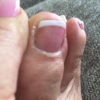 Roseville Nails Spa - 1st. Day of pedicure! My cuticles we're not trimmed nor wear my heels buffed out - Nail Salons Near Me - Roseville, California