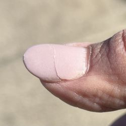 JM Nail Studio - Cracked thumb nail.